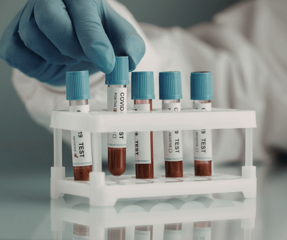 Blood sample tubes